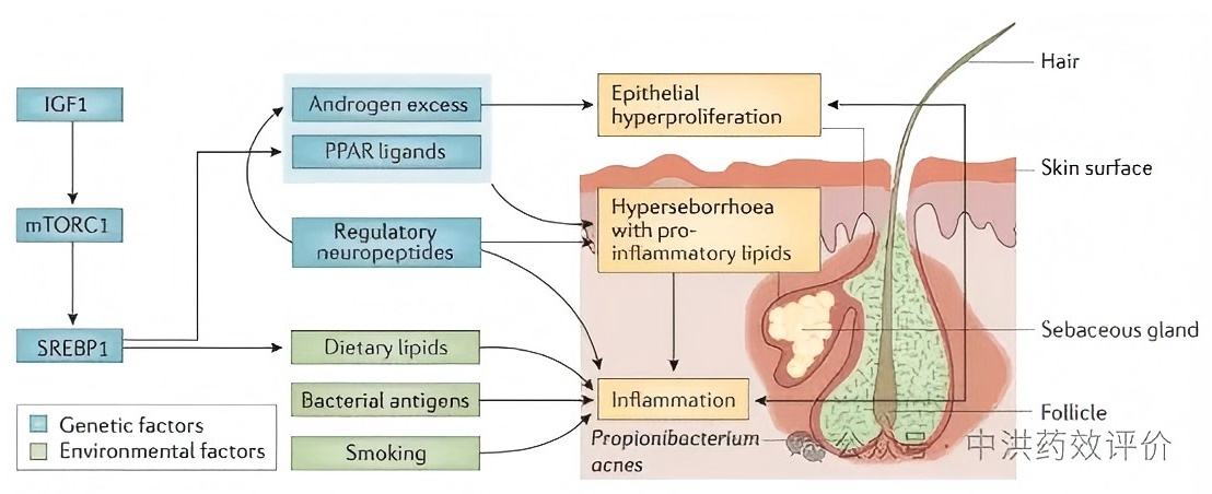 12月的痤疮新药研发赛道：四大药企各显神通，终于要和反复长痘说拜拜？