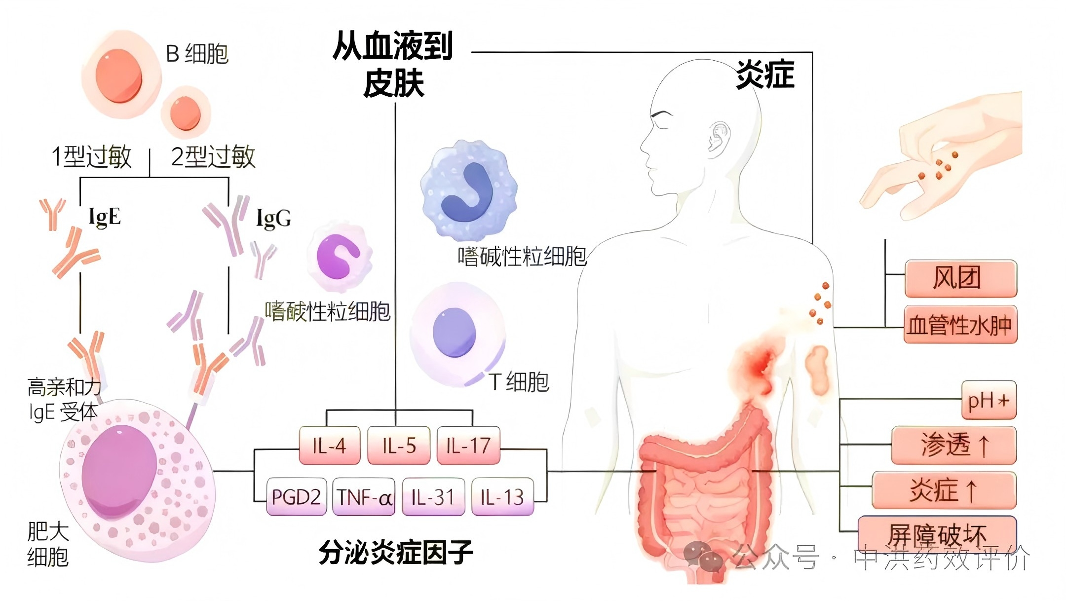慢性荨麻疹“根治”时代将启? 口服BTK抑制剂或成最终答案
