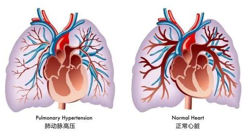 动物建模| 盘点肺动脉高压的几种建模方法 - 知乎