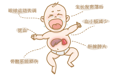 突破治疗瓶颈!戈谢病创新疗法研发迎来新征程