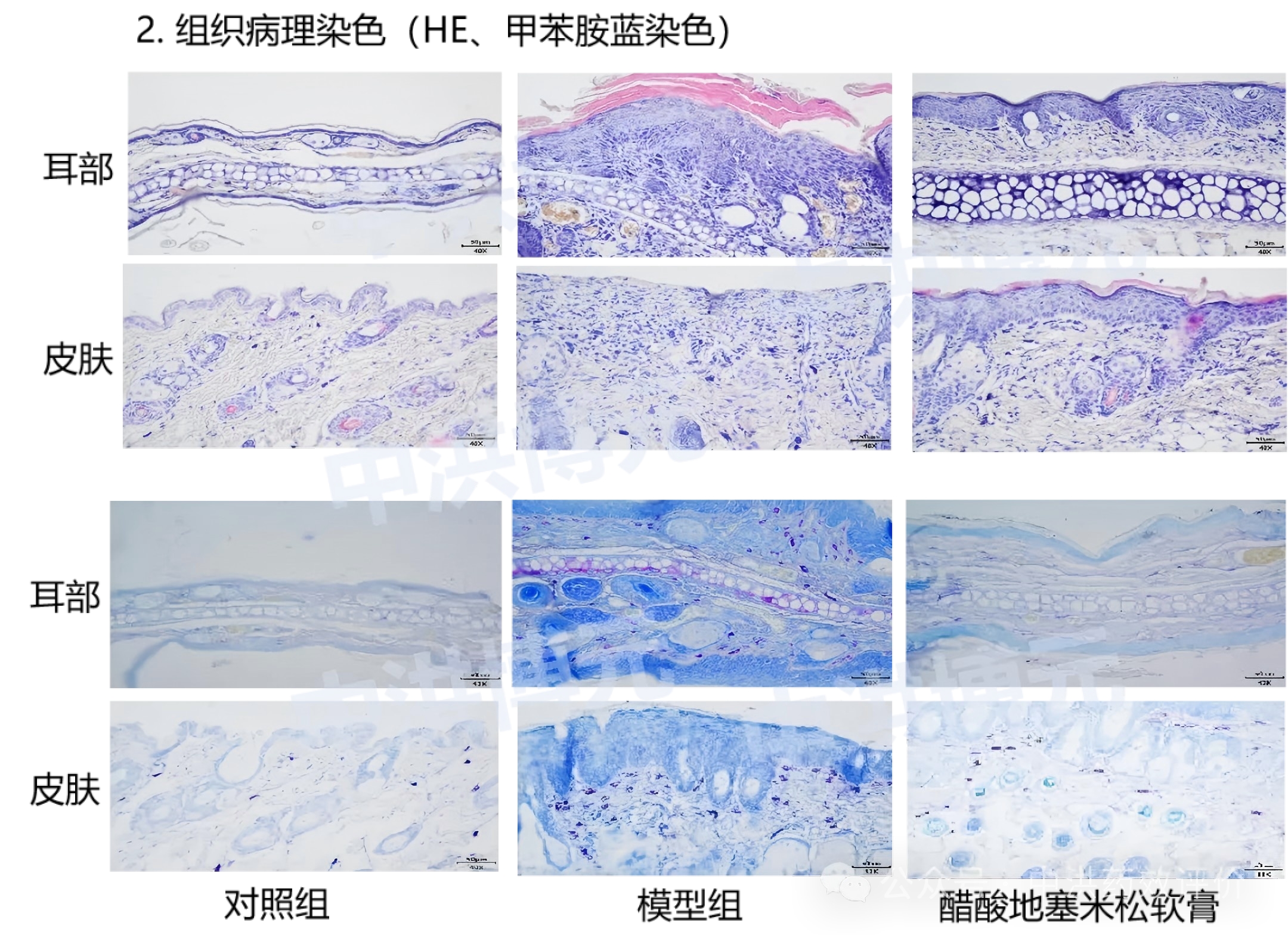 每年影响全球数亿人！特应性疾病迎来机制突破与靶向治疗新纪元